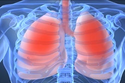 COPD 598093a96f896