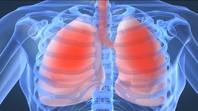 COPD 598093a96f896